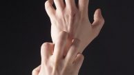 Latex Alerjisi Nedir?