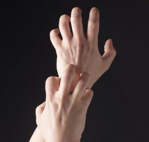 Latex Alerjisi Nedir?