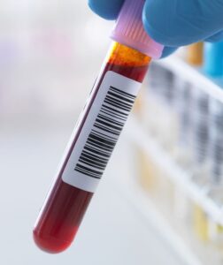 Kanda HbA1c Nedir ? Neden Önemlidir ?