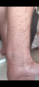 Mahalle bekçileri tarafından ölesiye dövülen H.E.S adalet arıyor….