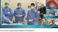 BALCALI’DAN TÜRKİYE’DEKİ HEKİMLERE CANLI YAYINLA LAPAROSKOPİK PROSTAT KANSERİ AMELİYATI YAPILDI